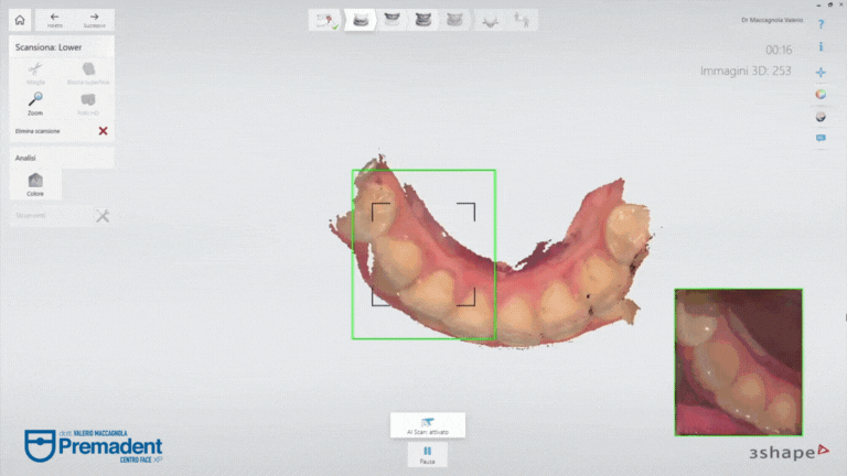 scansione intraorale modelli 3D